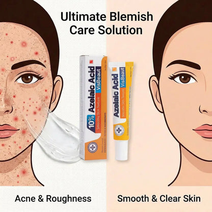 VisBeaut 10% Azelaic Acid Serum