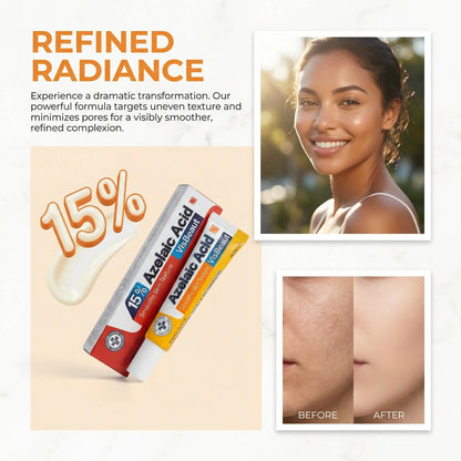 VisBeaut 15% Azelaic Acid Cream