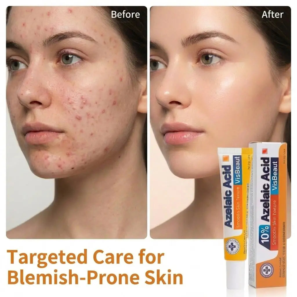 VisBeaut 10% Azelaic Acid Serum