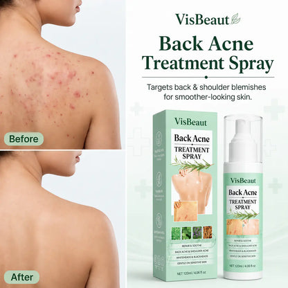 VisBeaut Back & Shoulder Acne Spray