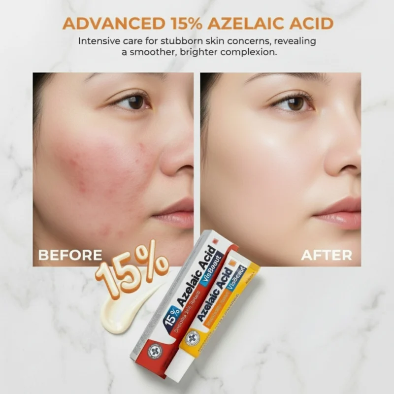 VisBeaut Azelaic Acid 15% Gel Cream